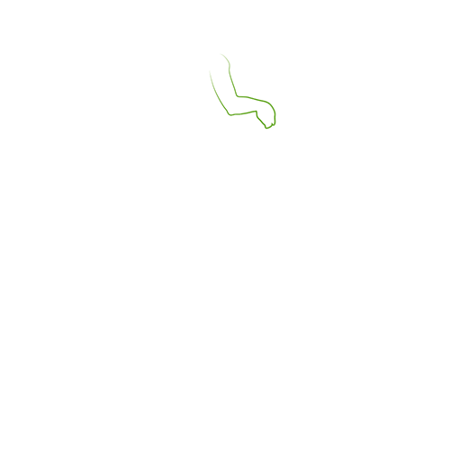 Grafik: Auswirkungen einer FSME - Abgeschlagenheit