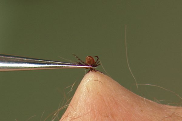 Aufnahme einer Zeckenentfernung mithilfe einer Pinzette