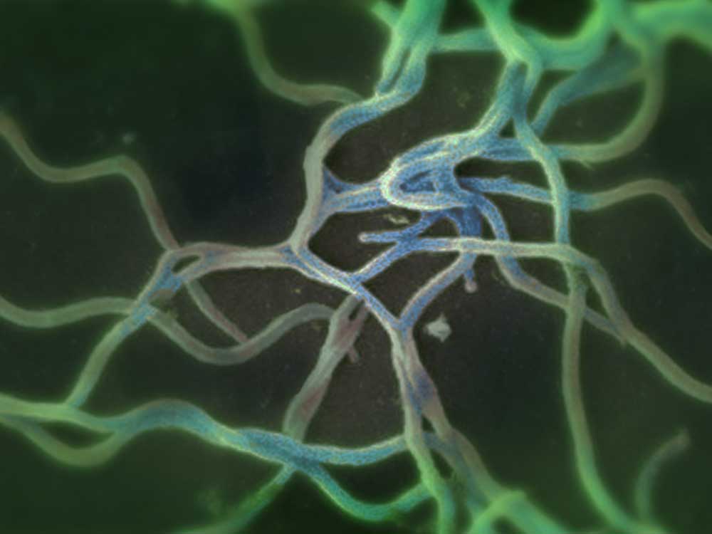REM-Aufnahme von Lyme-Borreliose Bakterien